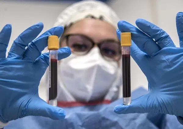 Covid, l'immunit&agrave; diminuisce nel tempo. Ecco perch&eacute; fare attenzione