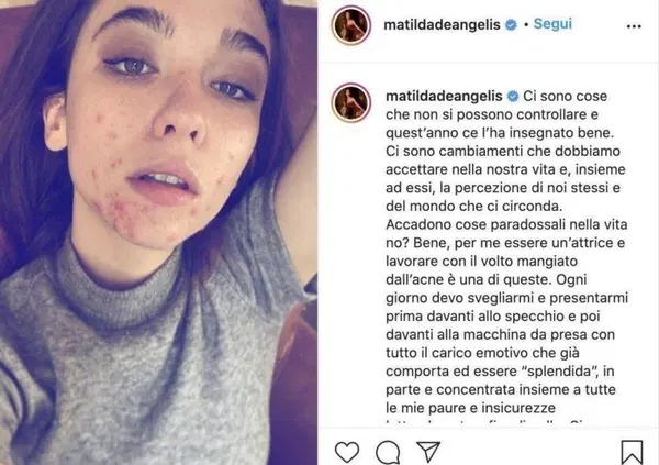 I brufoli di Matilda De Angelis sono la solita favola Disney "naturale vs artefatto&rdquo;