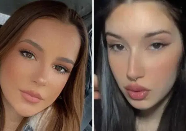 Schianto fatale per Eralda e Barbara: una delle due era terrorizzata dalla guida spericolata del suo ragazzo, il conducente della Bmw finita contro un albero