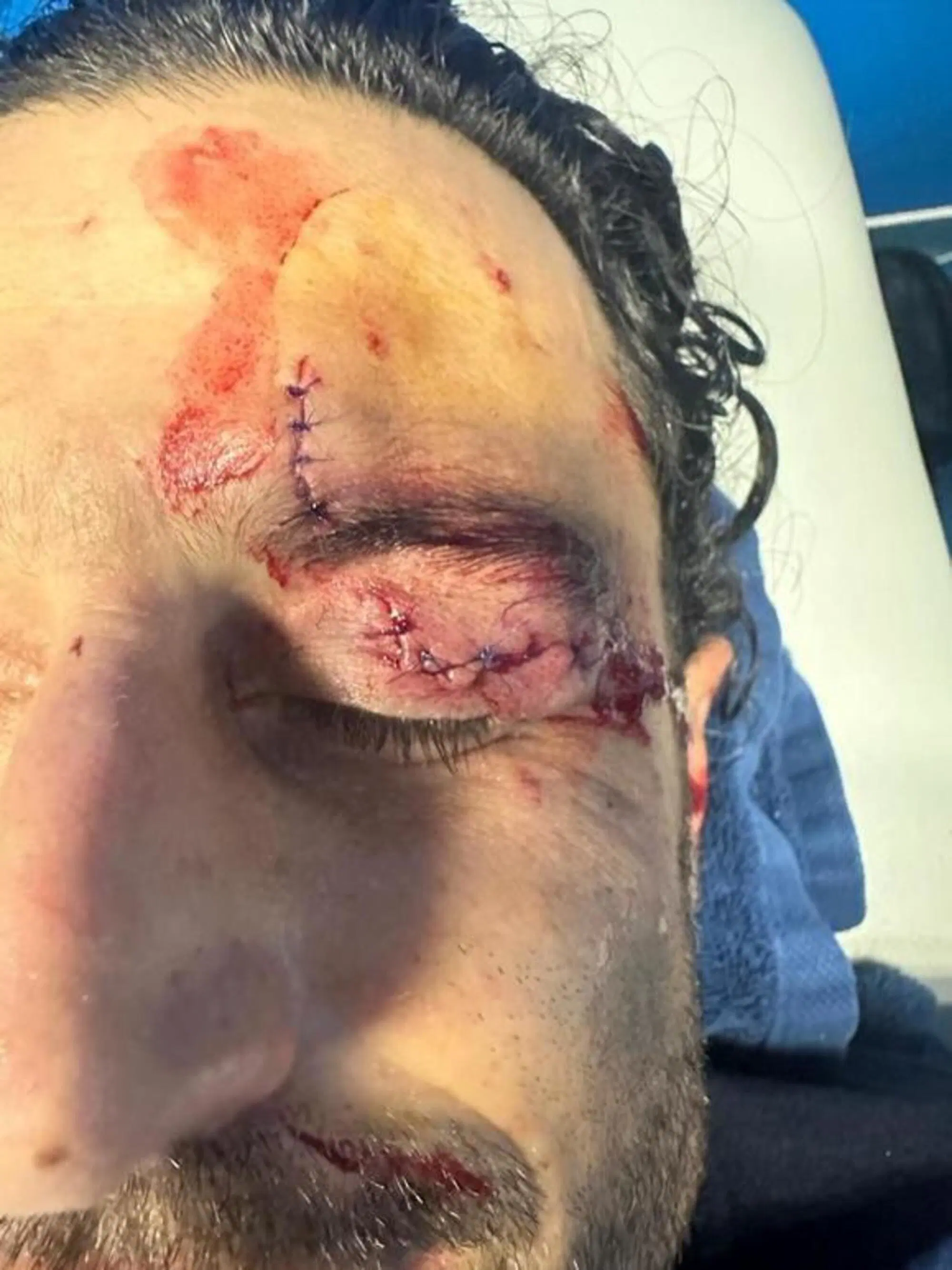 Fabio Grosso dopo l'aggressione dei tifosi