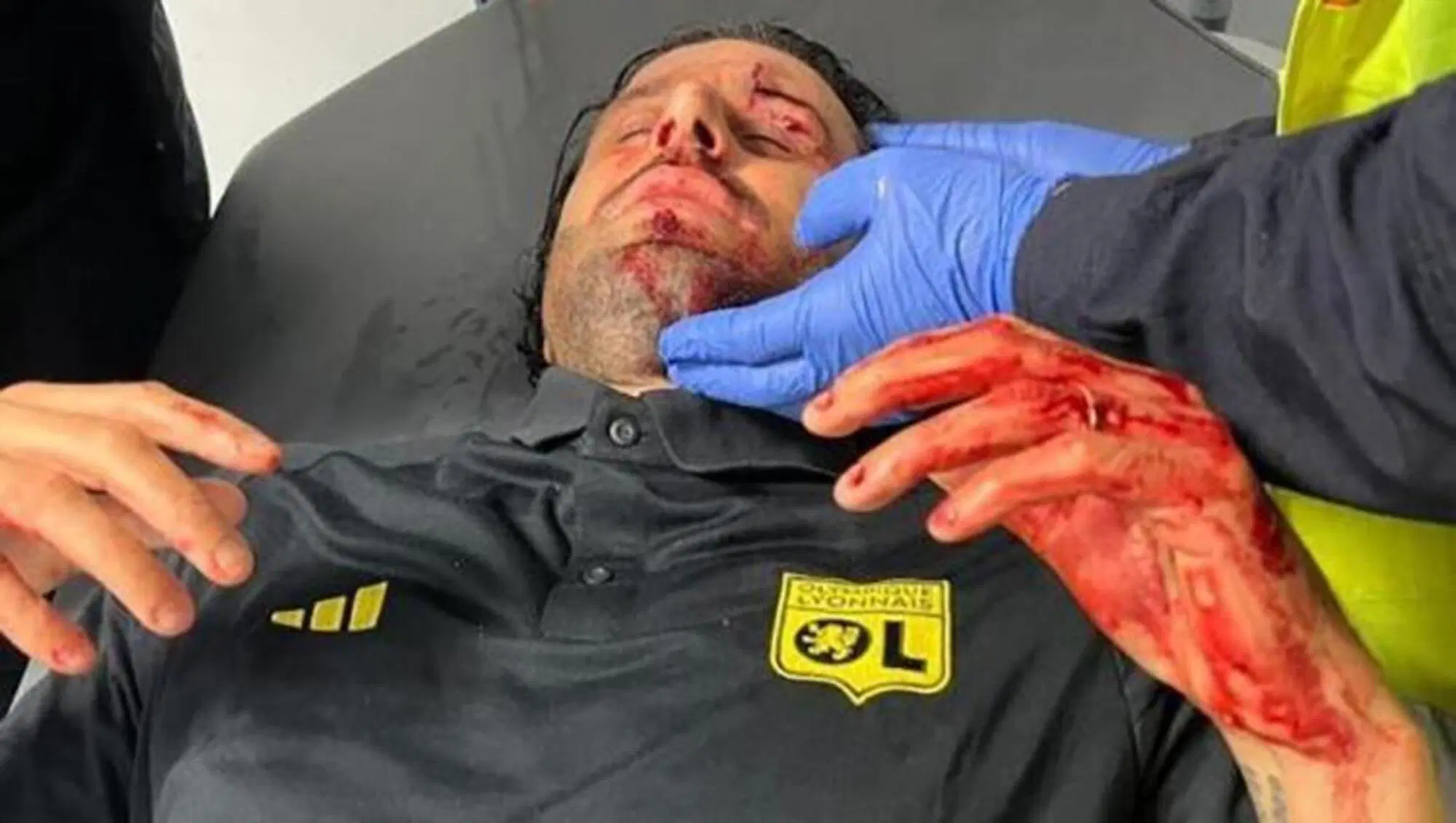 Fabio Grosso dopo l'aggressione dei tifosi