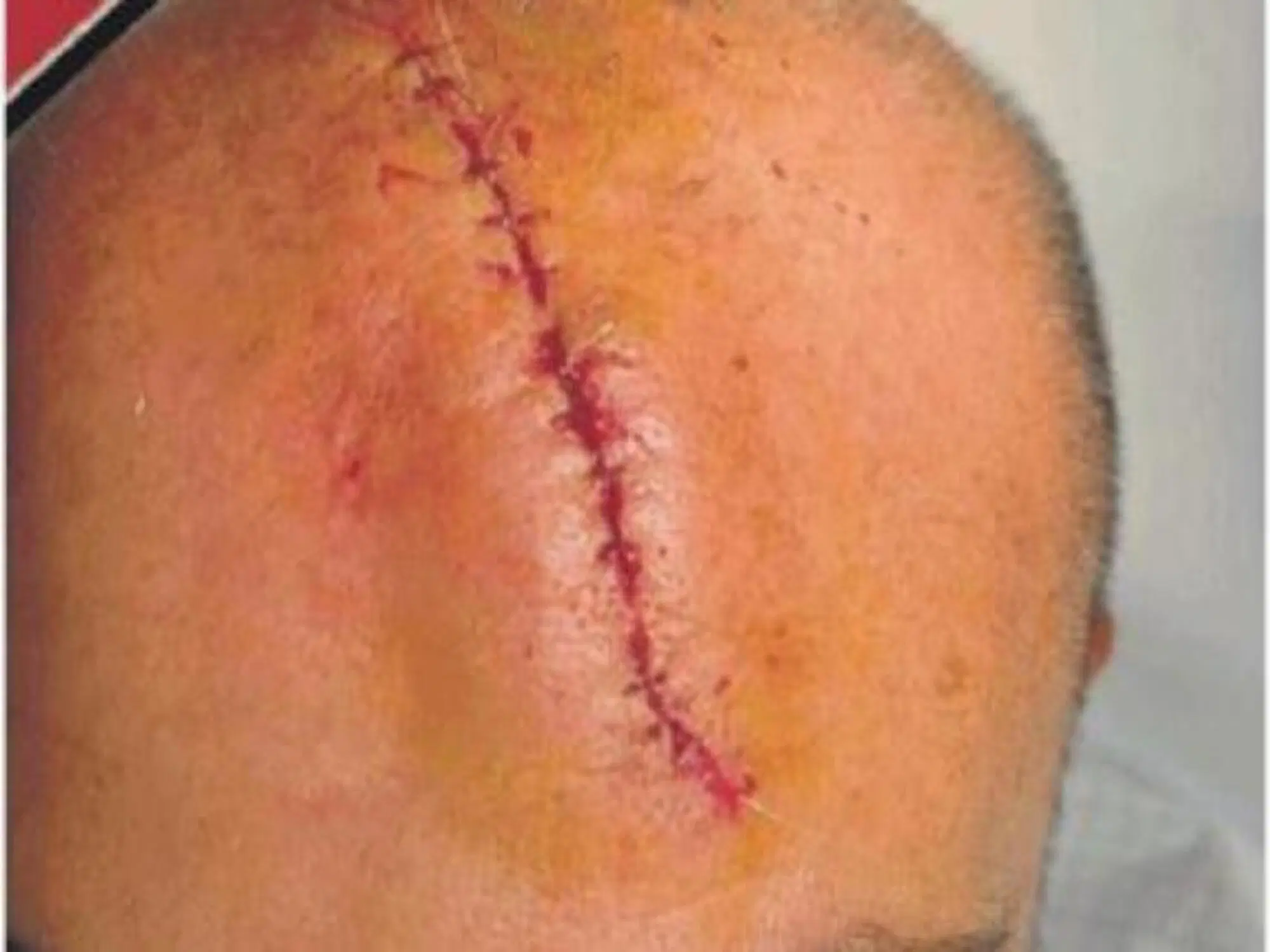 L'immagine della ferita di Sangiuliano