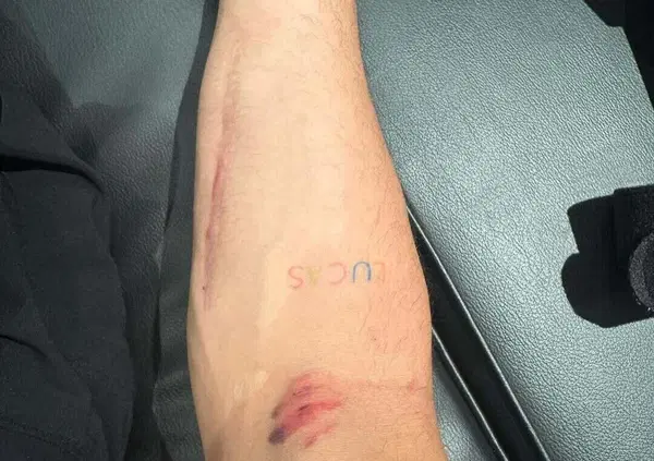 Forse v&rsquo;&egrave; sfuggito, ma Alex Rins in Qatar s&rsquo;&egrave; preso una sassata a 300 Km/h: &ldquo;impressionante&rdquo;. Poi picchia duro sulla crisi Yamaha