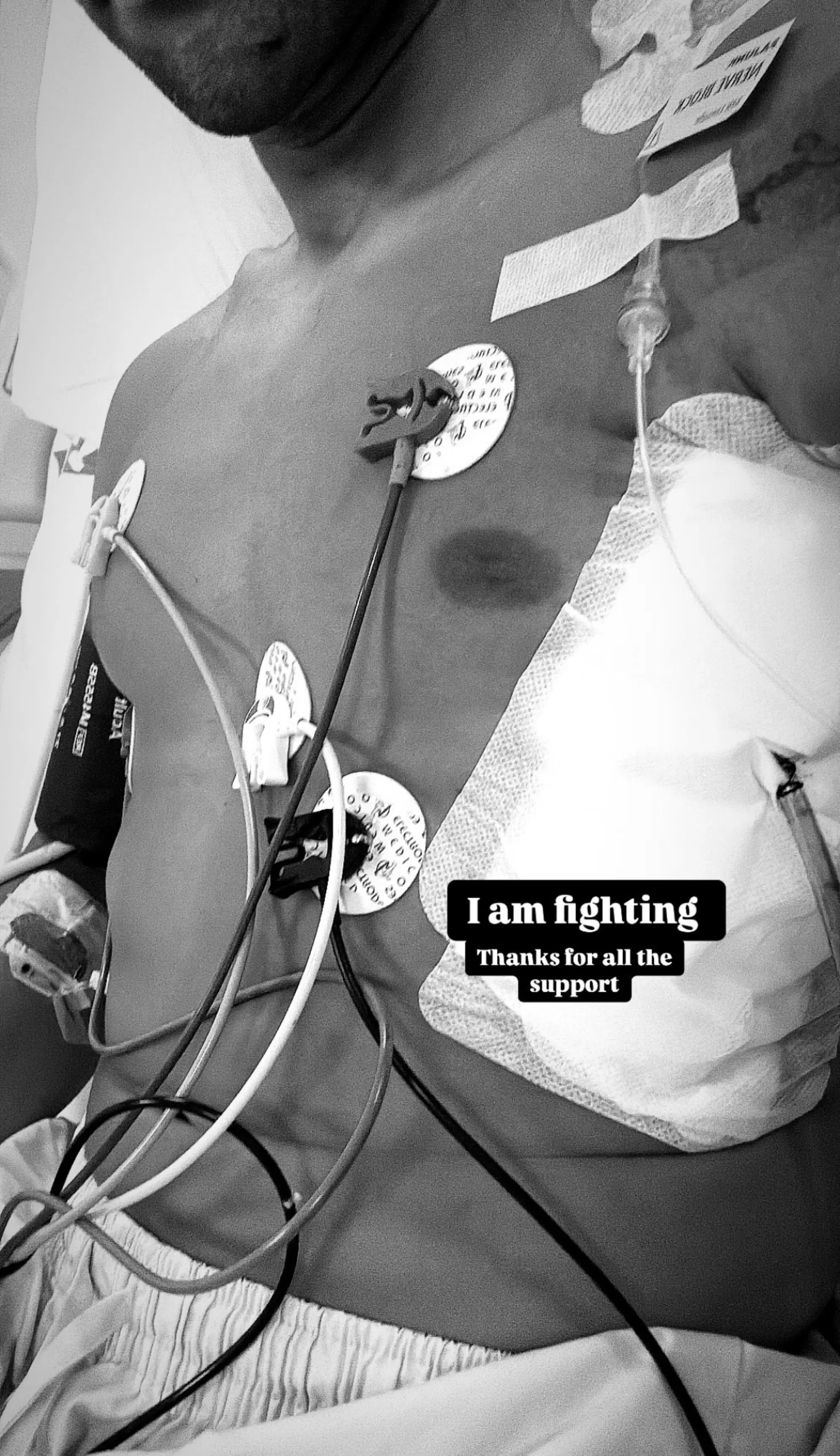 20250418 171441396 2009