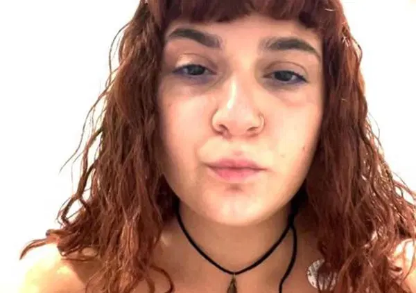 Caso reggiseno-tac? &ldquo;La vera vittima &egrave; il medico&rdquo;. Azzurra Barbuto smonta Marzia Sardo sulle molestie al Policlinico Umberto I: &ldquo;Le sue tette? Non avrebbe reso felice nessuno. Punta su quello perch&eacute;...&rdquo;. Catcalling o marketing?