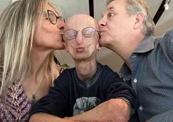 La malattia di Sammy Basso &egrave; stata un dono, parola di mamma e pap&agrave; (che ora pubblicano un libro introdotto da Jovanotti)